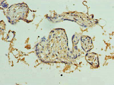 PKD1L2 antibody