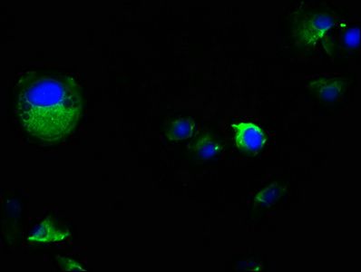 PKD2 Antibody