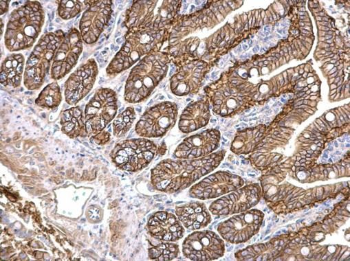 PKD2 antibody [C1C3]