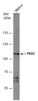 PKD2 antibody
