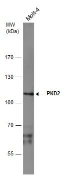 PKD2 antibody [C1C3]