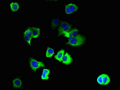 PKD2L2 Antibody