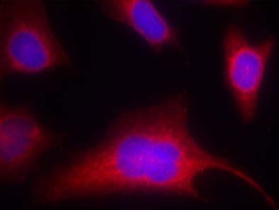 PKD/PKCμ (Phospho-Ser910) Antibody