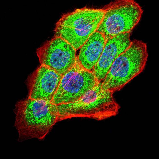 PKHD1 Antibody