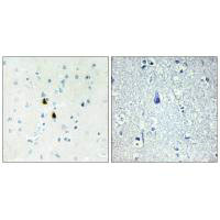 PKIA Antibody