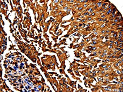 PKM Antibody