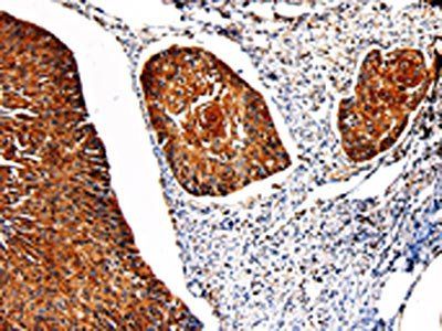 PKM Antibody