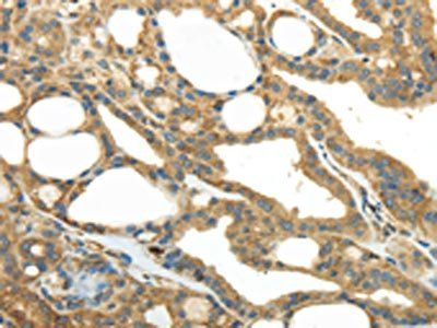 PKM Antibody