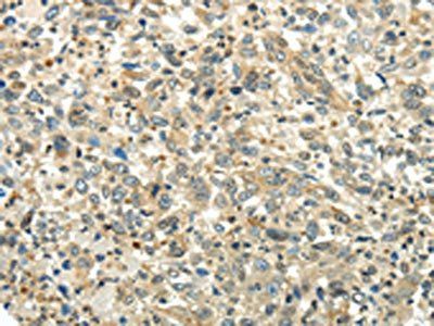 PKM Antibody