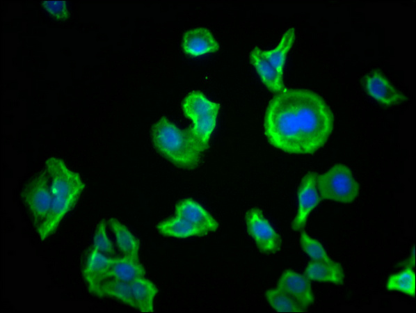 PKM Monoclonal Antibody