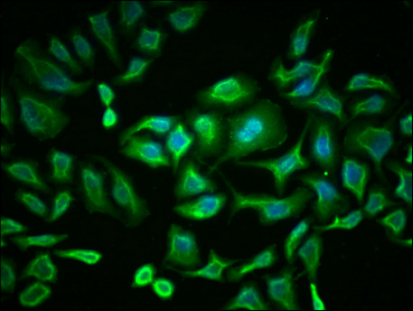 PKM Monoclonal Antibody