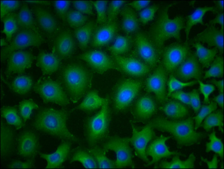 PKM antibody