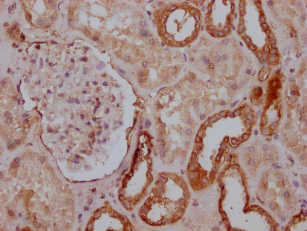 PKM Monoclonal Antibody