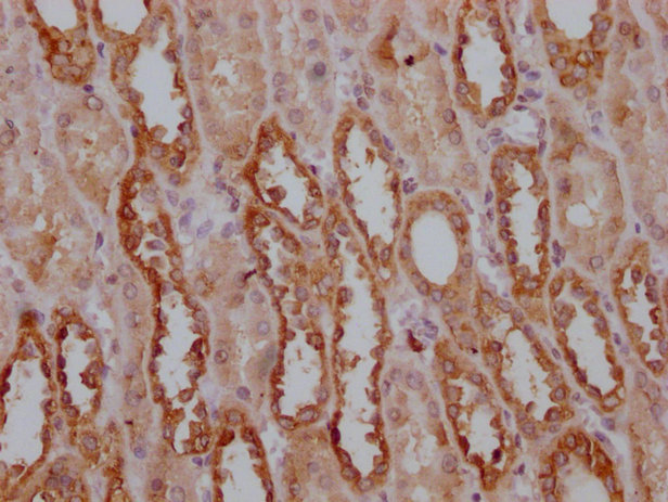 PKM Monoclonal Antibody