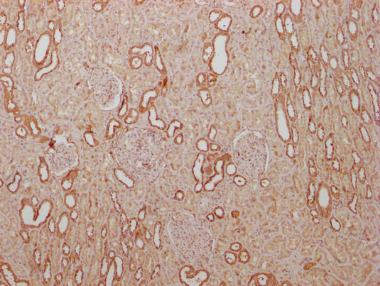 PKM Monoclonal Antibody