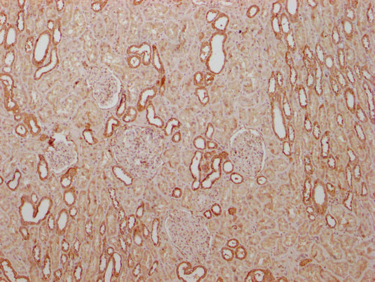 PKM antibody