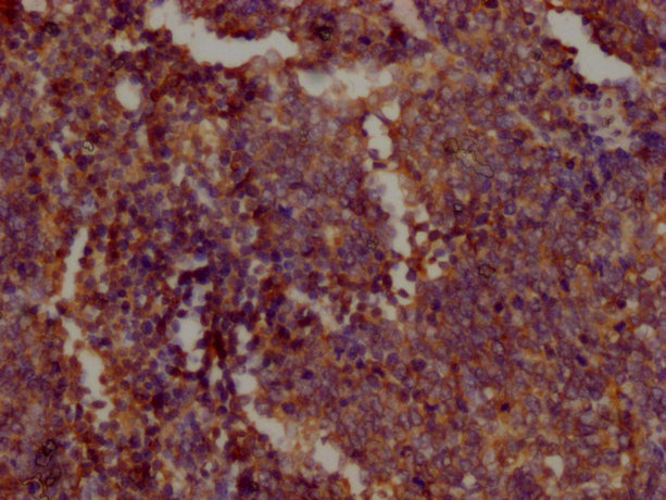 PKM Monoclonal Antibody