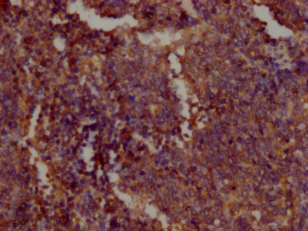 PKM antibody