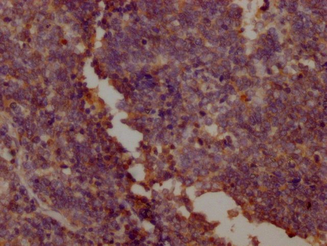 PKM Monoclonal Antibody