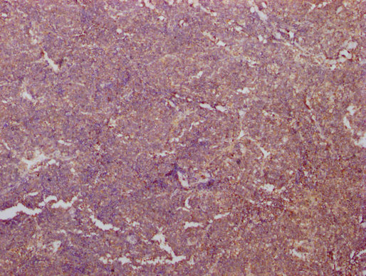 PKM antibody