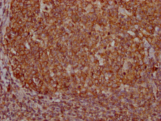 PKM Monoclonal Antibody