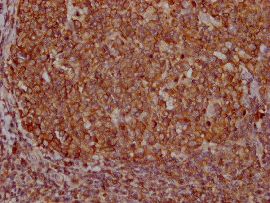 PKM antibody