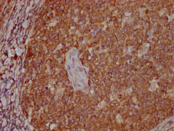 PKM Monoclonal Antibody