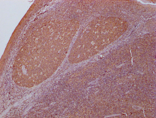 PKM Monoclonal Antibody
