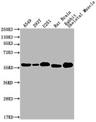 PKM antibody