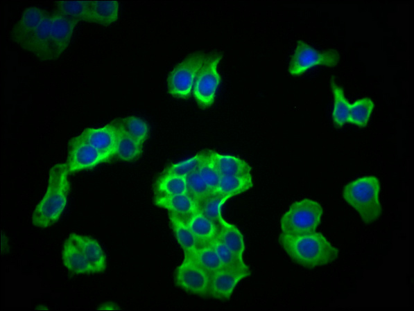 PKM Monoclonal Antibody