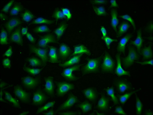 PKM Monoclonal Antibody