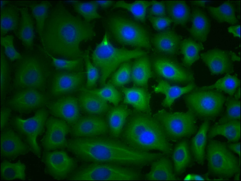 PKM Monoclonal Antibody