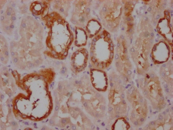 PKM Monoclonal Antibody