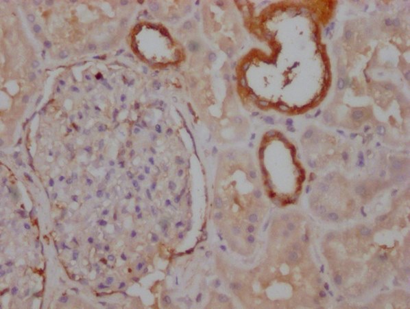 PKM Monoclonal Antibody