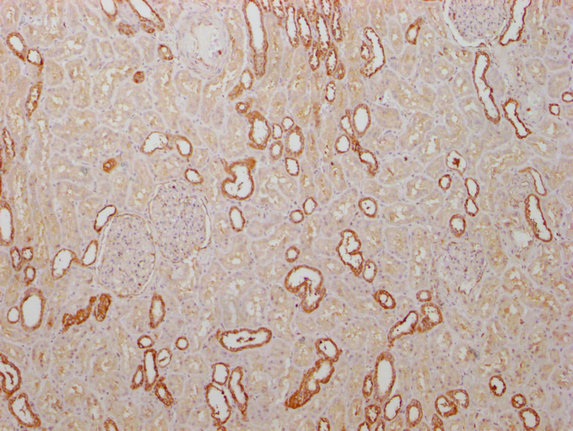 PKM antibody