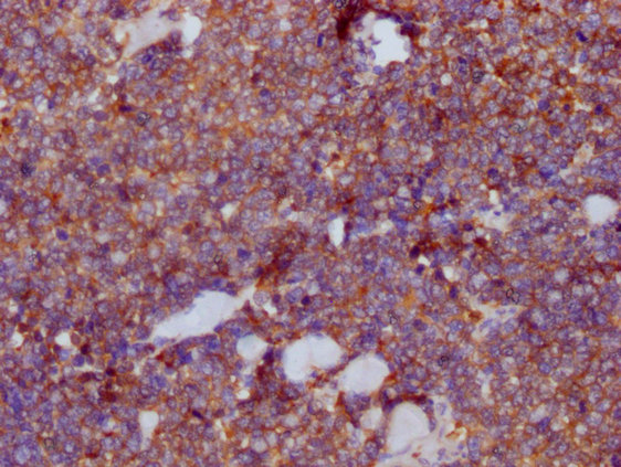 PKM Monoclonal Antibody