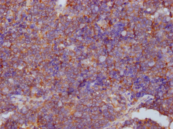 PKM Monoclonal Antibody