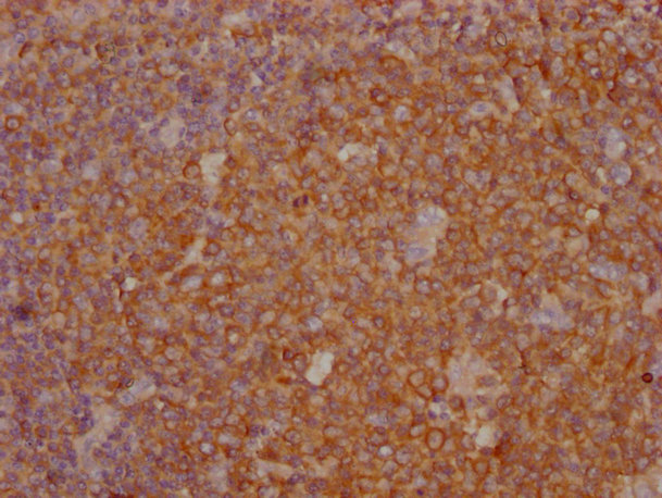 PKM antibody