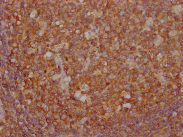 PKM antibody