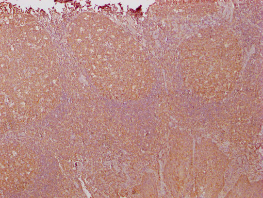 PKM Monoclonal Antibody