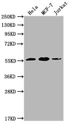 PKM antibody