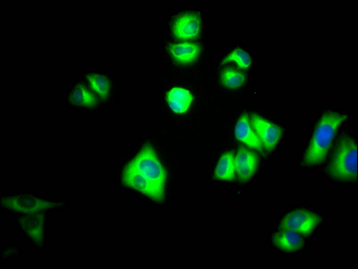 PKM antibody