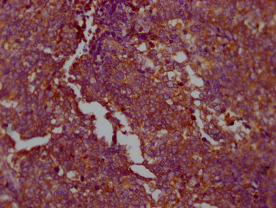 PKM Recombinant Monoclonal Antibody