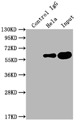 PKM antibody