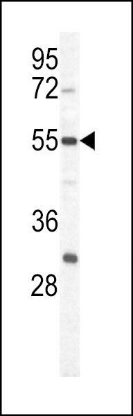 PKM1 antibody