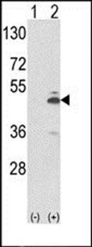 PKM2 antibody