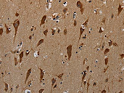PKMYT1 Antibody