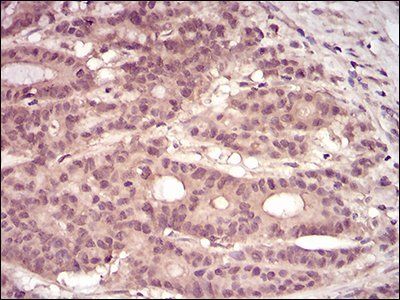 PKN1 Antibody