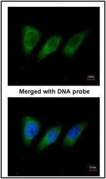 PKN2 antibody [N1N3]