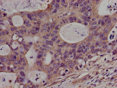 PKN2 Antibody